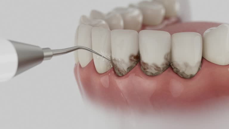 Trusted Teeth Cleaning And Checkup service in Clarkston, GA - Dentist Open Now